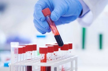 Μεγάλο Αιματολογικό Πακέτο Εξετάσεων Ιατρικού Check Up και Έλεγχος Θερεοειδούς (TSH), με Εκτίμηση των Αποτελεσμάτων από Ιατρό, στο Κέντρο! Μεγάλο Αιματολογικό Πακέτο Εξετάσεων Ιατρικού Check Up και Έλεγχος Θερεοειδούς (TSH), με Εκτίμηση των Αποτελεσμάτων από Ιατρό, στο Κέντρο!