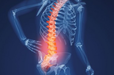 Ολοκληρωμένος Αιματολογικός Έλεγχος Οστεοπόρωσης, με Εκτίμηση των Αποτελεσμάτων από Ιατρό, στο Κέντρο! Ολοκληρωμένος Αιματολογικός Έλεγχος Οστεοπόρωσης, με Εκτίμηση των Αποτελεσμάτων από Ιατρό, στο Κέντρο!