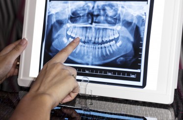 1 Ψηφιακή Πανοραμική Ακτινογραφία Δοντιών, με Παράδοση των αποτελεσμάτων σε CD, στο Χαλάνδρι! 1 Ψηφιακή Πανοραμική Ακτινογραφία Δοντιών, με Παράδοση των αποτελεσμάτων σε CD, στο Χαλάνδρι!