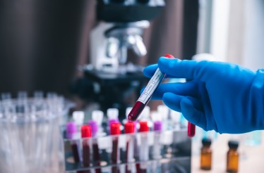 Βασικό Αιματολογικό Check-Up για Ενήλικες & Παιδιά, στο Διαγνωστικό Κέντρο «Alpha Διάγνωση», στο Μετρό Δάφνης!