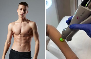 Laser Ανδρική Αποτρίχωση, ασφαλής και αποτελεσματική 12 μήνες τον χρόνο, με το τελευταίας γενιάς Candela GentleLase Pro Alexandrite Laser 755 nm και επιλογή Περιοχών σε Πρόσωπο & Σώμα, στην Άνω Τούμπα!