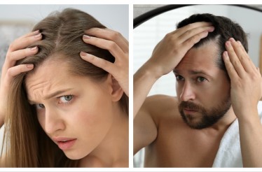 Ενέσιμη Αυτόλογη PRP Μεσοθεραπεία, η Φυσική και Ασφαλής Θεραπεία για την Τριχόπτωση, στην Τσιμισκή!