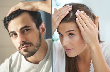 Tricho-DNA Test, μία εξατομικευμένη γενετική εξέταση για την τριχόπτωση, στην Τσιμισκή!