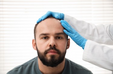 Θεραπείες Νέας Γενιάς κατά της Τριχόπτωσης, με τις πρωτοποριακές μεθόδους PDRN & EXO-PDRN για επανόρθωση & ενδυνάμωση μαλλιών, στην Τσιμισκή!